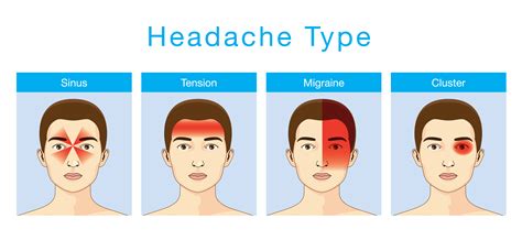 Types Of Headaches Chart Image