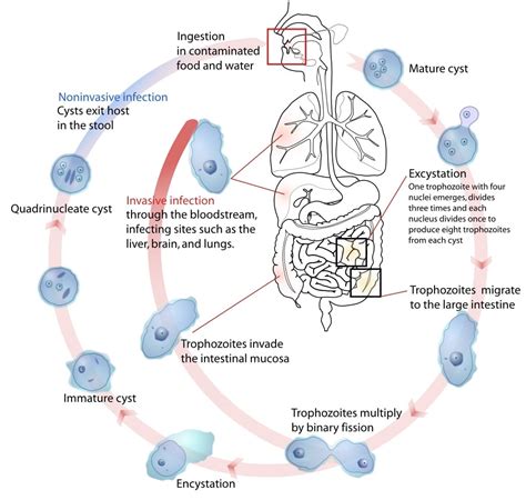 Gastroenteritis - Management - Causes - TeachMeSurgery