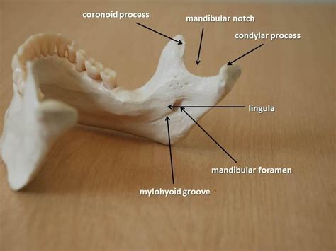 Anatomy of the mandible: mandibular notch, condylar process, lingula ...