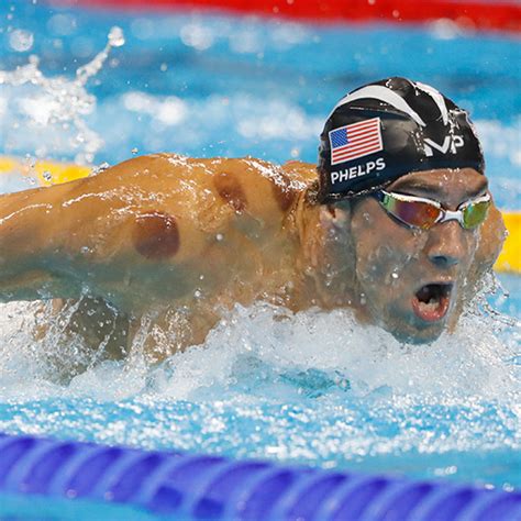 Michael Phelps and cupping: All about this therapy | My Southern Health