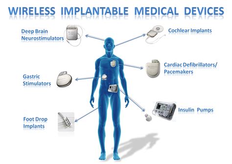 IMD Shield: Securing Implantable Medical Devices