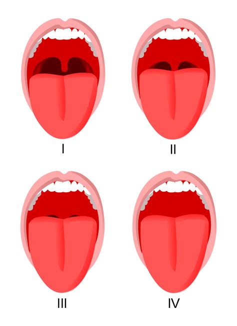 Airway Assessment