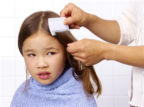 How to Find Head Lice in Your Child's Hair