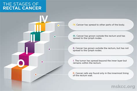 Rectal Cancer Stages 0, 1, 2, 3, 4 | Memorial Sloan Kettering Cancer Center