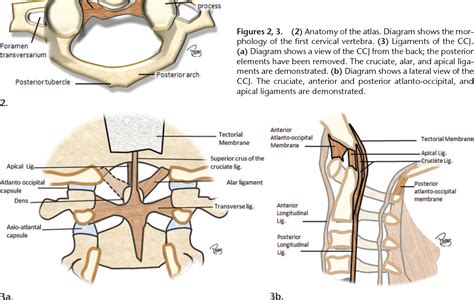 Atlanto Occipital Joint Ligaments