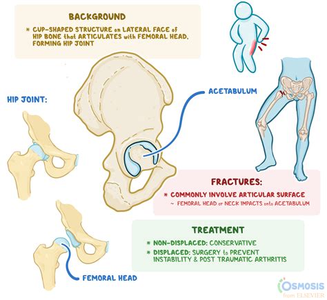 Acetabulum: What Is It, Function, Fractures, and More | Osmosis