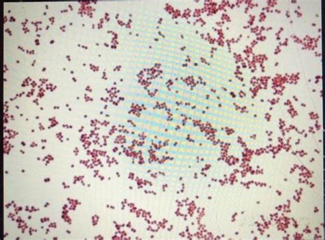 Solved Unknown Bacteria1. Endospore Stain Results (positive | Chegg.com