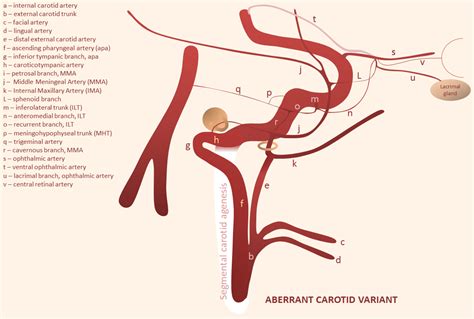 Middle Meningeal Artery | neuroangio.org