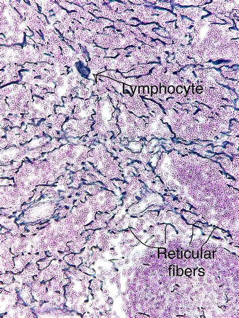 Reticular Connective Tissue