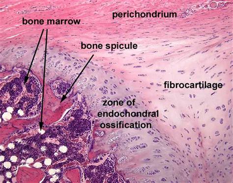 Endochondral Ossification Histology