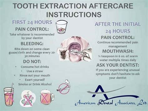 Tooth Extraction Aftercare Instructions | Dental Care | Pinterest ...