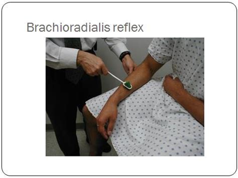 Brachioradialis Reflex