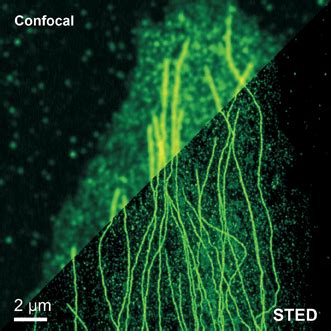 STED Microscopy Made Easy | Features | Dec 2014 | Photonics Spectra