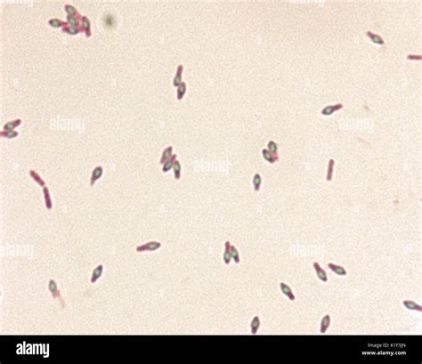 Clostridium botulinum spores stained with malachite green stain. The ...