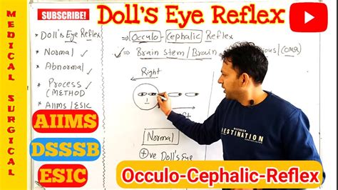 Doll's eye reflex | Occulo Cephalic Reflex | neurological examination ...