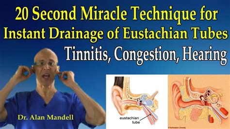 Sign in | Eustachian tube dysfunction, Ear health, Lymphatic drainage ...