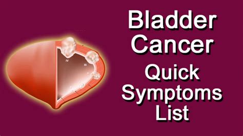 Bladder Cancer Quick Symptoms List - YouTube