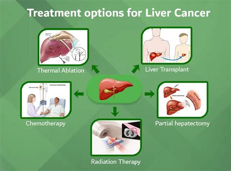 Liver Cancer Treatments- Surgery, Chemotherapy, Radiation and ...