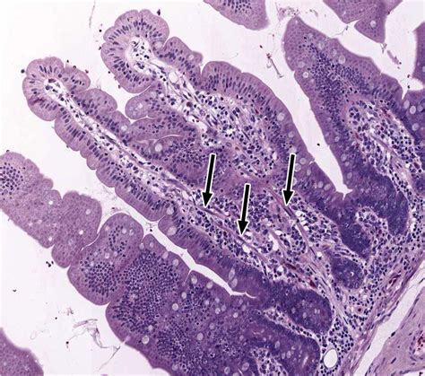 Small and Large Intestine | histology