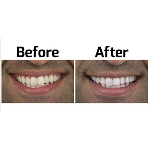 Opalescence Go 15 Teeth Whitening Trays Boxed, 10 pack, Mint ...