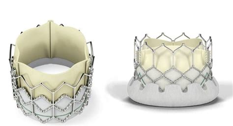 FDA Approves Edwards' SAPIEN 3 Ultra Transcatheter Heart Valve - iData ...