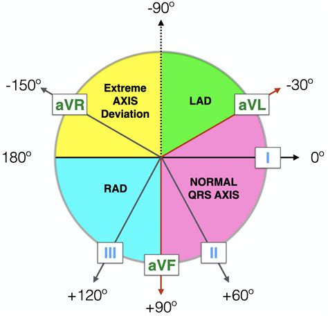 ECG Axis Interpretation • LITFL • ECG Library Basics