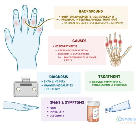 Heberdens Nodes Xray