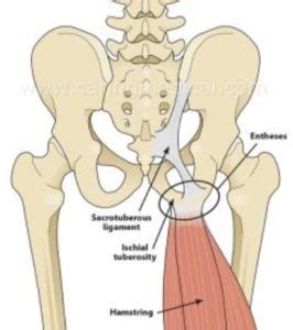 Sit Bone Pain / Ischial Tuberosity (2023)