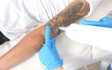 Tattoo Removal Creams: A Guide for Beginners | LaserAll