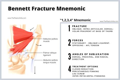 Bennett Fracture - X-Rays, Diagnosis, Treatment.