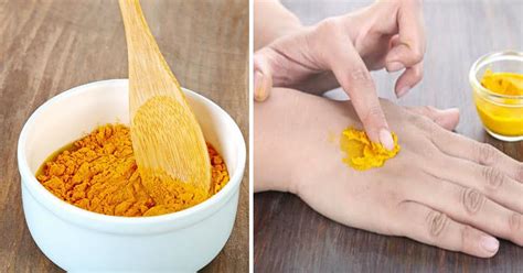 7 Home Remedies for Skin Fungus That Actually Work - Small Joys