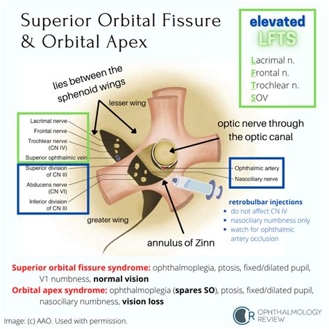 Superior Orbital Fissure Nerves