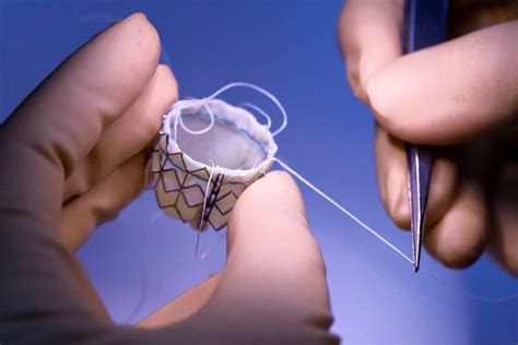 Edwards Lifesciences Introduces Sapien Heart Valve Cautiously - WSJ