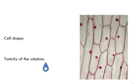 Solved Cell shape:Tonicity of the solution: | Chegg.com