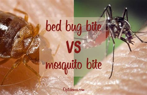 Bed Bug Bites Vs Mosquito Bites How To Identify Them – NBKomputer