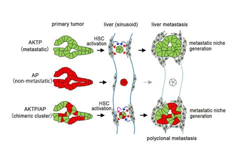 Insights into Drivers of Metastasis Uncovered