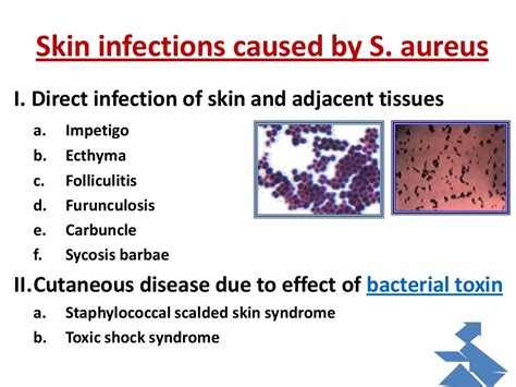 Bacterial infection of the skin