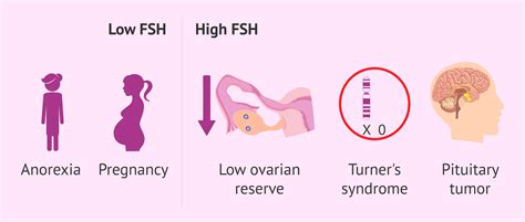 Alterations of FSH values in women