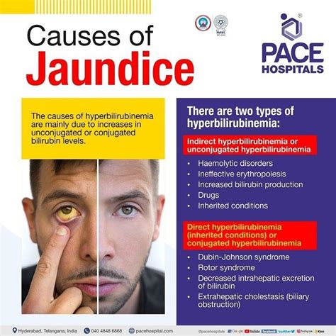 Jaundice Disease - Symptoms, Causes, Complications and Prevention