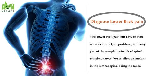 An Overview Of Low Back Pain Causes, Risk Factors And, 60% OFF