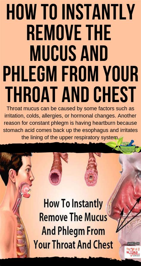 What Causes Excessive Phlegm In The Throat