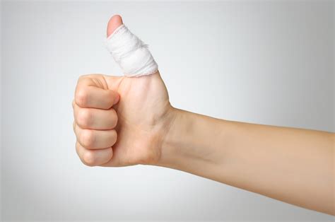 Sprained Thumb | Cause and Recovery Time | OrthoIndy Blog