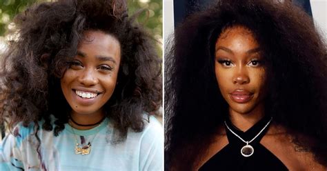 SZA Before Surgery: See the Singer's Drastic Transformation