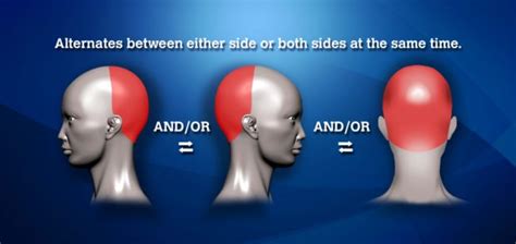 Headache Chart, Location, and Symptoms For Headaches Types