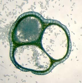 Psilotum – Sporangium | BIOL/APBI 210 Lab Information