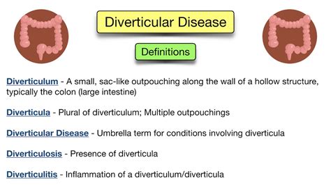 Diverticular Disease: Diverticulitis vs Diverticulosis - Symptoms, Diet ...