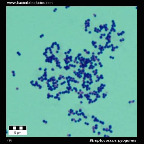 Streptococcus Pyogenes Under Microscope Microscopy Of Gram Positive ...