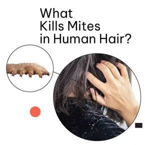 Hair Dandruff, Hair Scalp, Hair Hair, Mites On Humans, Demodex Mites ...