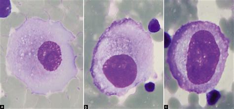 The panorama of different faces of mesothelial cells - CytoJournal