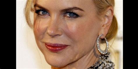 Nicole Kidman Confirms: I've Had Botox | Fox News